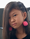 The Girl Who Is Allergic to Everything Kyra Yip